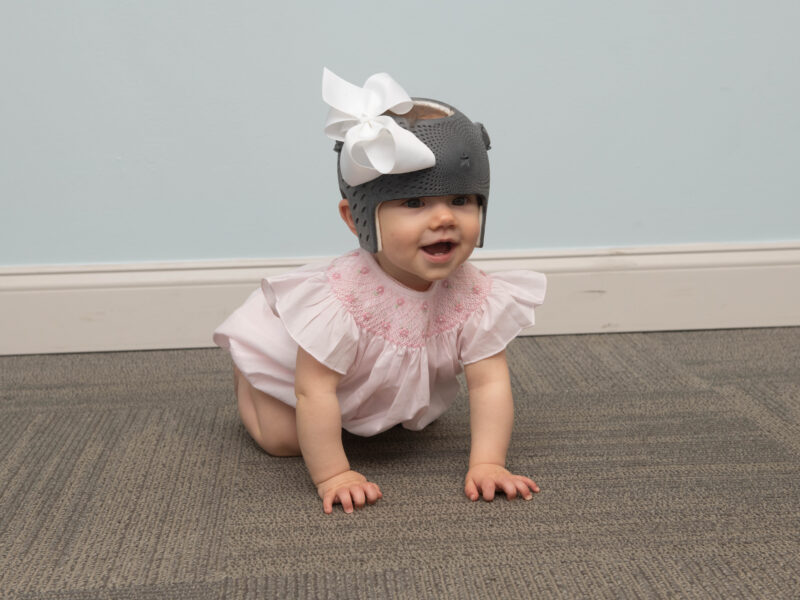 3d Printed Cranial Helmet For Girls