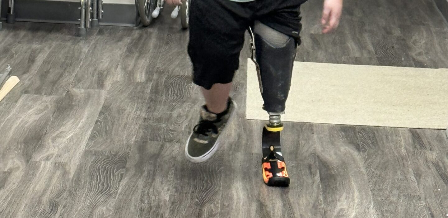 Prosthetics