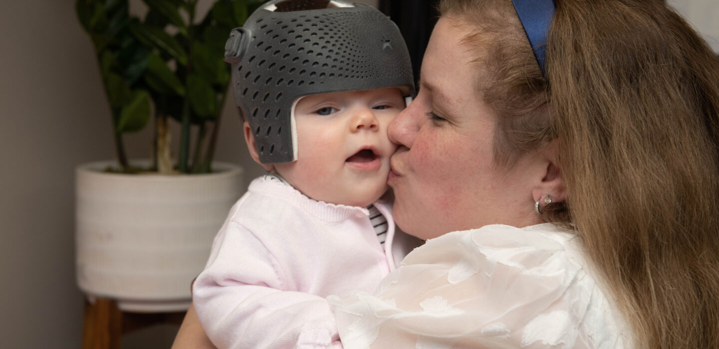 3d printed cranial helmet 6