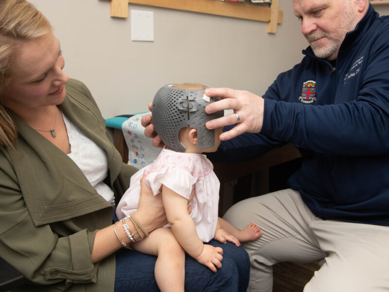 3d printed cranial helmet placement