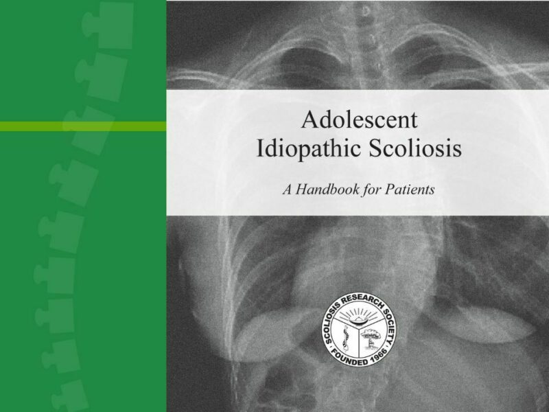 Ais idiopathic scoliosis handbook nbopri